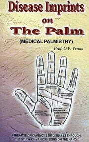 Disease Imprints On The Palm By Prof O P Verma [RP]