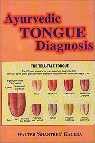 A YURVEDIC TONGUE DIAGNOSIS